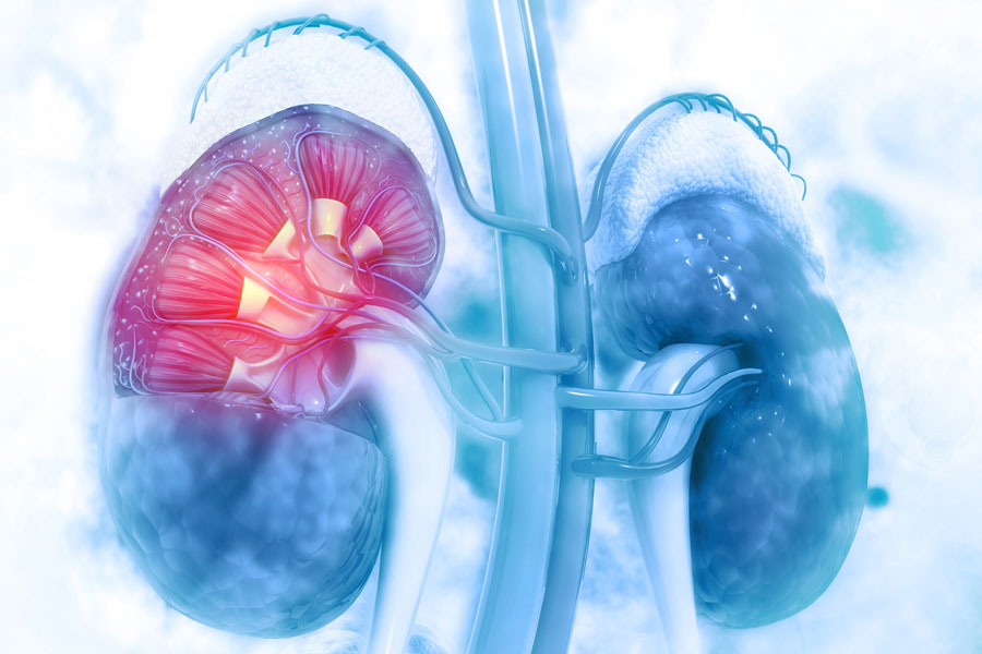 Why Caring For Your Kidneys Can Improve Urological Health