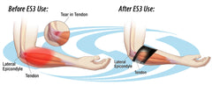 Compression Elbow Sleeve ES3